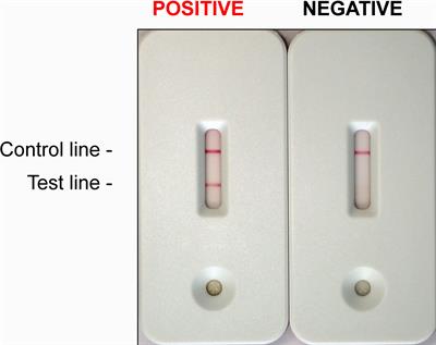 Lateral Flow Immunoassay for the Detection of Panton-Valentine Leukocidin in Staphylococcus aureus From Skin and Soft Tissue Infections in the United Arab Emirates